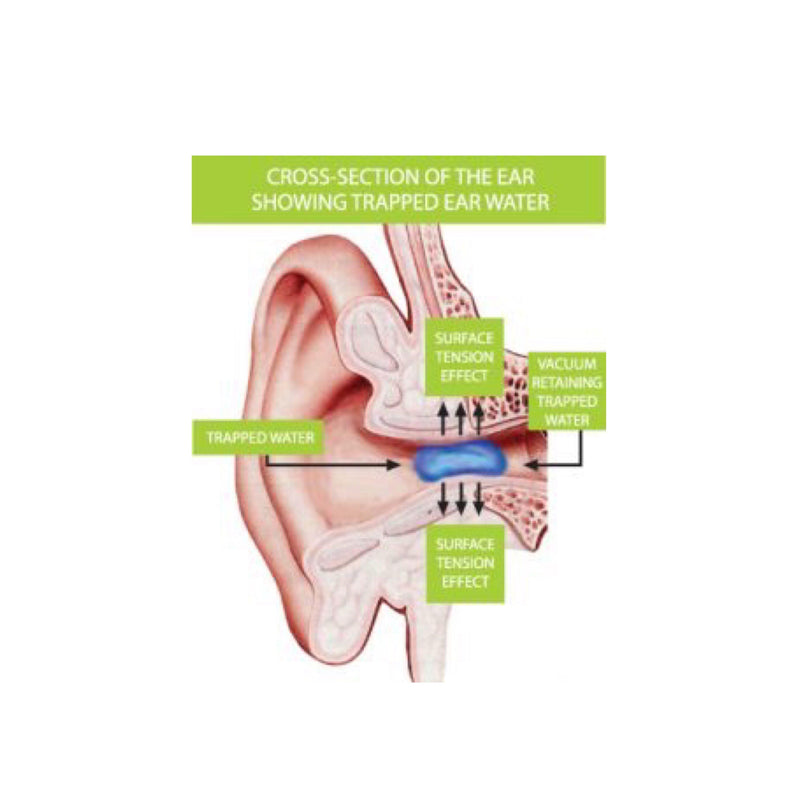 Wax-eze Ear Wax Clearance Ear Drops 10ml - Skin Health - Sincere Medistore- 衛耳適耳滴劑10毫升 - 皮膚護理用品 -友誠網店